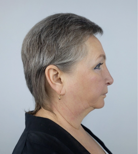 Woman with short gray pixie haircut shown in profile view against neutral background