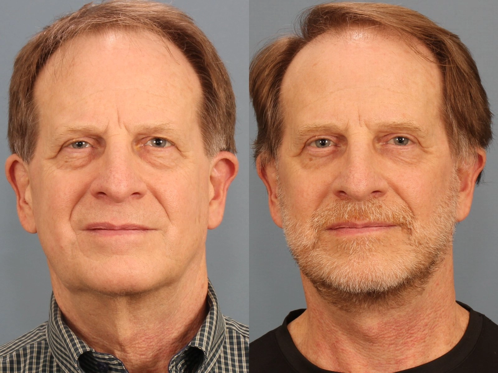 Berklich,+Jeffrey++(20231107170633647)+20240607152014029