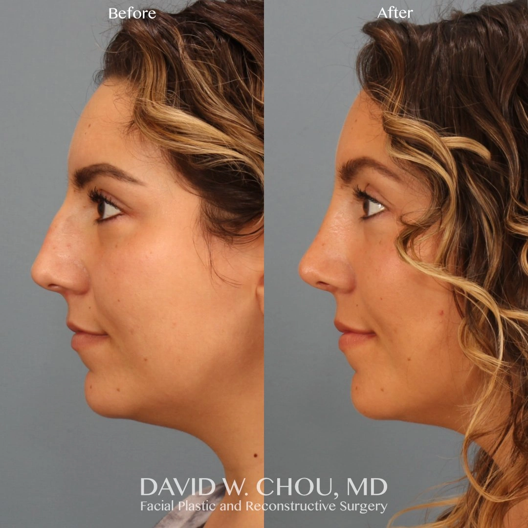 5223-p12-2