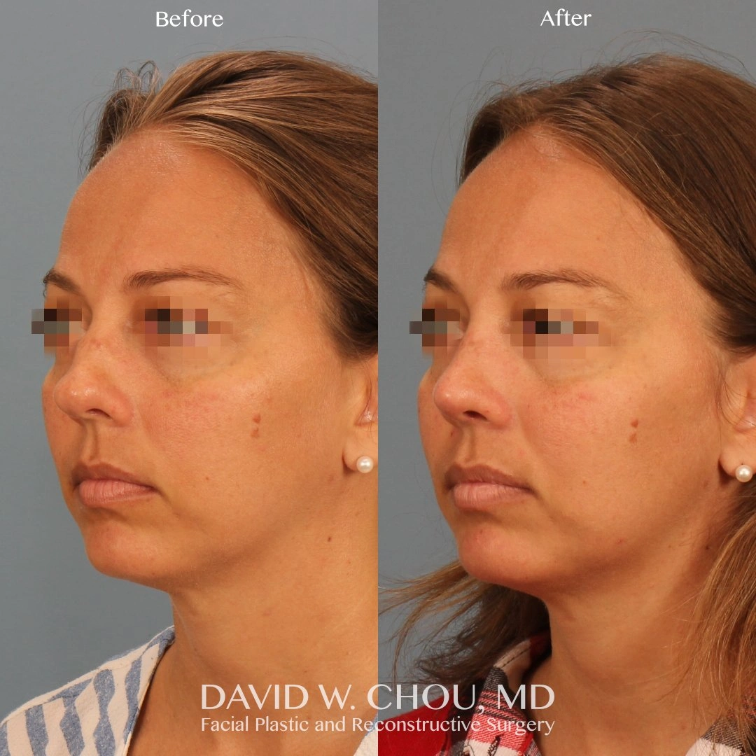 5199-p8-4